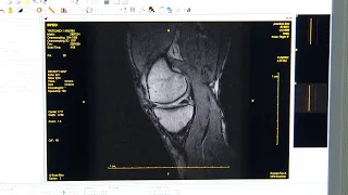 Пациенти од струмички регион реагираат дека мора приватно да се снимаат на компјутерска томографија