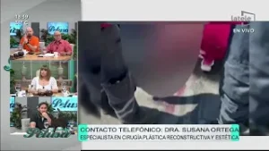 Mujer que perdió el cuero cabelludo, recibirá una membrana amniótica humana. Dra. Susana Ortega.