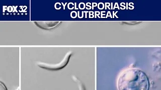 Cyclosporiasis outbreak: What to know as Illinois cases climb above 150