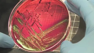 State leaders seeing more salmonella cases