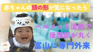 [Happy Baby Project] Concerned about your baby's head shape? How "helmet therapy" can round out t...