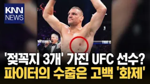 전 세계 몇 안되는 특징? '다유두증' UFC 파이터 화제 / KNN