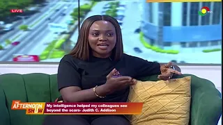 How Burns Affected Her Relationships: Judith Cato Addison Shares