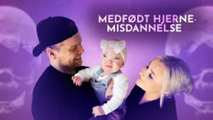 Pigen med bulen i panden (1:5) | En sjælden misdannelse