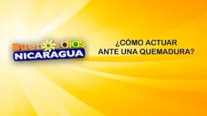 ¿Cómo actuar ante una quemadura?