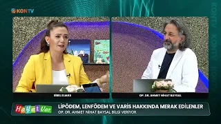 LIFE EXISTS - WHAT IS LYMPHEDEMA? DIAGNOSIS AND TREATMENT METHODS - OP. DR. AHMET NIHAL BAYSAL - ...