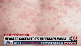 Pennsylvania has 977 reported measles cases this year so far