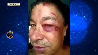 ¿Qué le pasó a Tun Tun? | Es Show