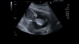 INEGI REVEALS A DRASTIC DROP IN BIRTH RATE IN THE STATE OF QUERÉTARO