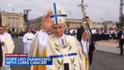 Pope has lung cancer and lower lobe of his right lung was removed, Vatican says
