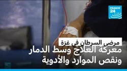 مرضى السرطان في غزة.. معركة العلاج وسط الدمار ونقص الإمكانات والأدوية