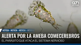 Water, heat, and poor hygiene: the combo that fosters the brain-eating amoeba