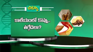 కాలేయంలో కొవ్వు... తగ్గేదెలా ? | Fatty liver... how can you reduce it ? | Sukhibhava | ETV Life