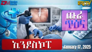 ጩራ ጥዕና ፡ ኢንዶስኮፒ | chura tiena - Endoscopy procedure - ERi-TV