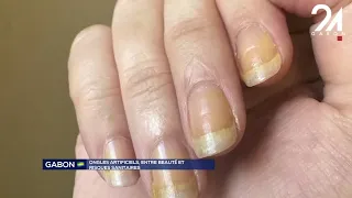 GABON SOCIETY: ARTIFICIAL NAILS, BETWEEN BEAUTY AND HEALTH RISKS