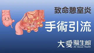 【大愛醫生館】 致命憩室炎 20260928