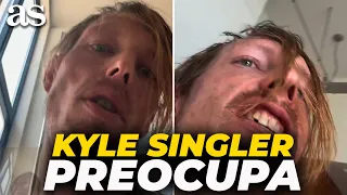The DEPLORABLE PHYSICAL and HEALTH STATE of FORMER Real Madrid PLAYER Kyle Singler