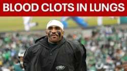 Blood clots found in Jalen Hurts' lungs; Eagles QB out for season
