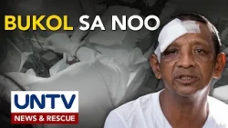 Padre de pamilya mula Cavite, naoperahan ang bukol sa noo sa tulong ng Serbisyong MCGI