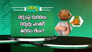 చర్మంపై దురదలు,దద్దుర్లు ఎంతకీ తగ్గడం లేదా?Health Tip: Itchyskin and rashes that just won’t go away?