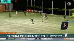 LPF Daily: Emmanuel Gómez suffers nasal fracture in incident during match against Alianza FC