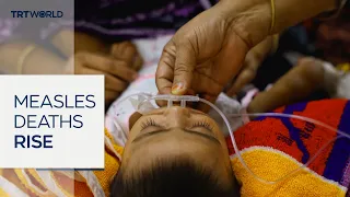 Bangladesh measles outbreak kills nearly 750 people since March