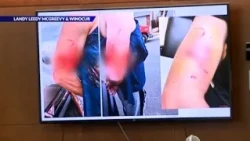 Civil Rights Trial Begins After Man Was Attacked By Aurora Police K9