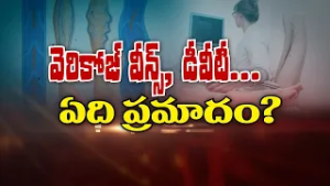 వెరికోజ్ వీన్స్, డీవీటీ... ఏది ప్రమాదం? | Varicose veins, DVT which one is Danger? | Sukhibhava