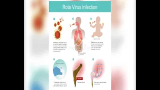 Rota virus može dovesti do ozbiljnih komplikacija kod dece