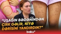 “Uşaq ağlaya-ağlaya çıxıb” | “Mika lazer” salonunda nə baş verib? | “Bədəni bütün yaradır” - Baku TV