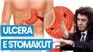 TË RREZIKSHME që ndikojnë në MUKOZËN e STOMAKUT - Mjeku zbulon USHQIMET që duhet te tregoni KUJDES